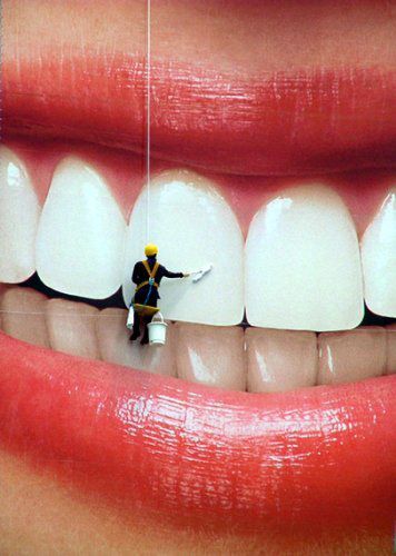 Teeth Whitening Results